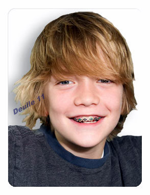 teen-boy-braces.jpg